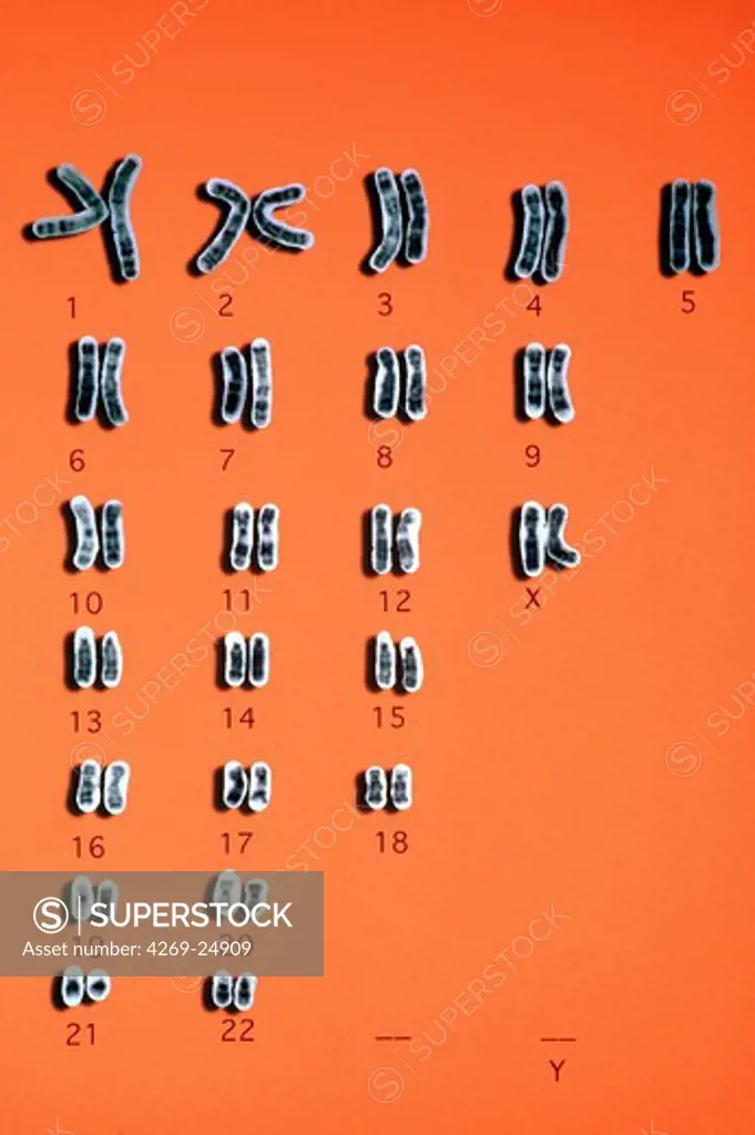 Normal femal karyotype. Chromosomes Caryotype