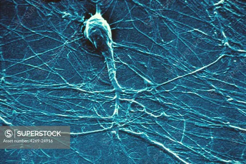 Neuron. Motor neuron SEM (Scanning Electron Microscope)