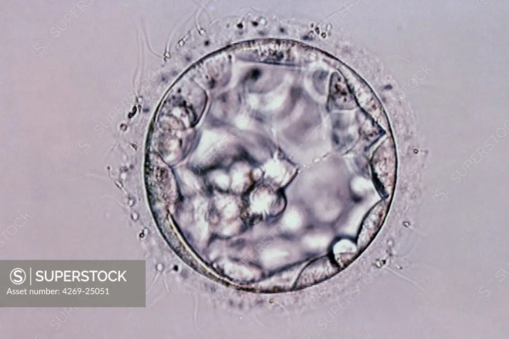 Blastocyste. Fertilized oocyte : 5 to 7 days embryo Light microscope