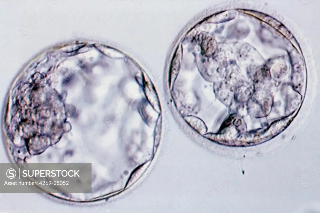 Blastocyste. Fertilized oocytes : 5 to 7 days embryo Light microscope
