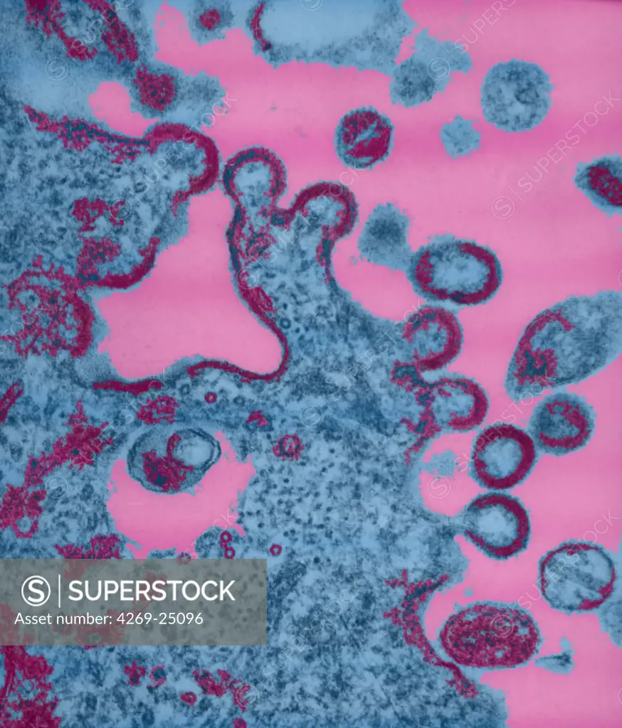 AIDS virus. TEM (Transmission Electron Microscope)