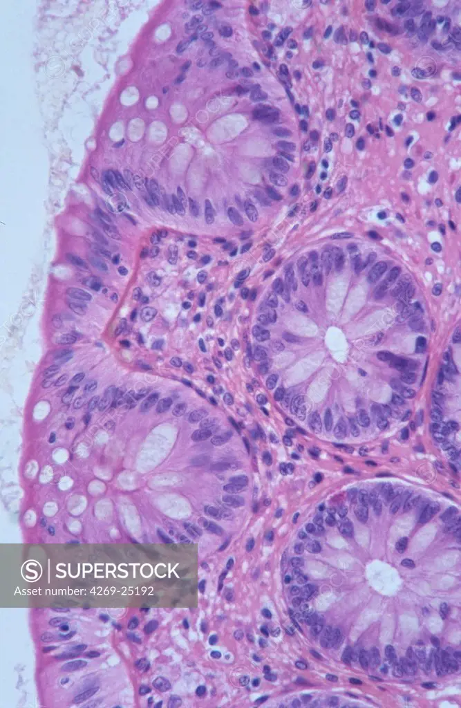 Histology. Normal goblet cells (mucous cell) covering the mucosa of the colon. Light microscopy.