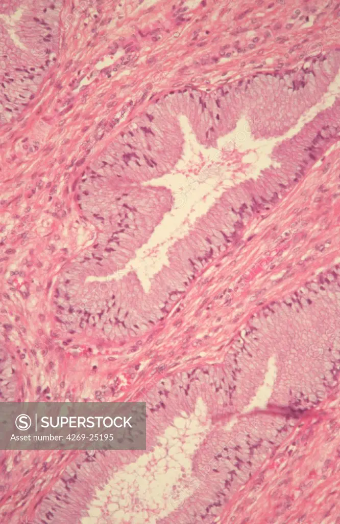 Endocervix uteri normal gland. Light microscopy