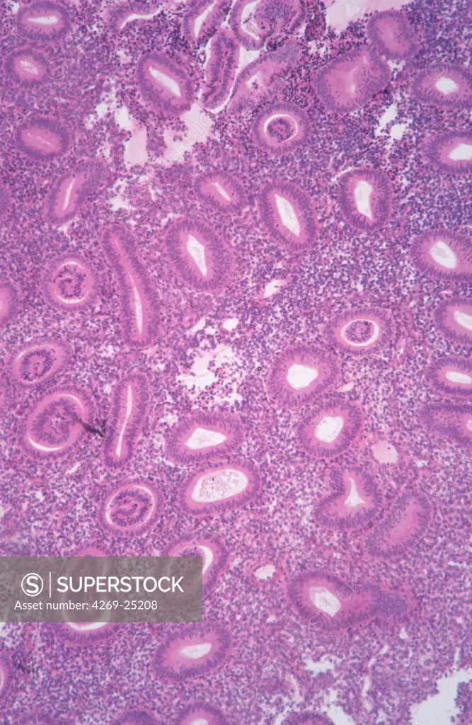 Normal endometrium cells. Light microscopy
