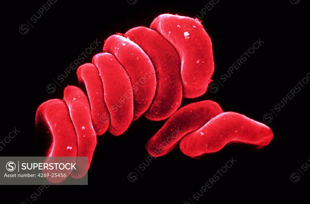 Blood cell. Blood red cells SEM (Scanning Electron Microscope)