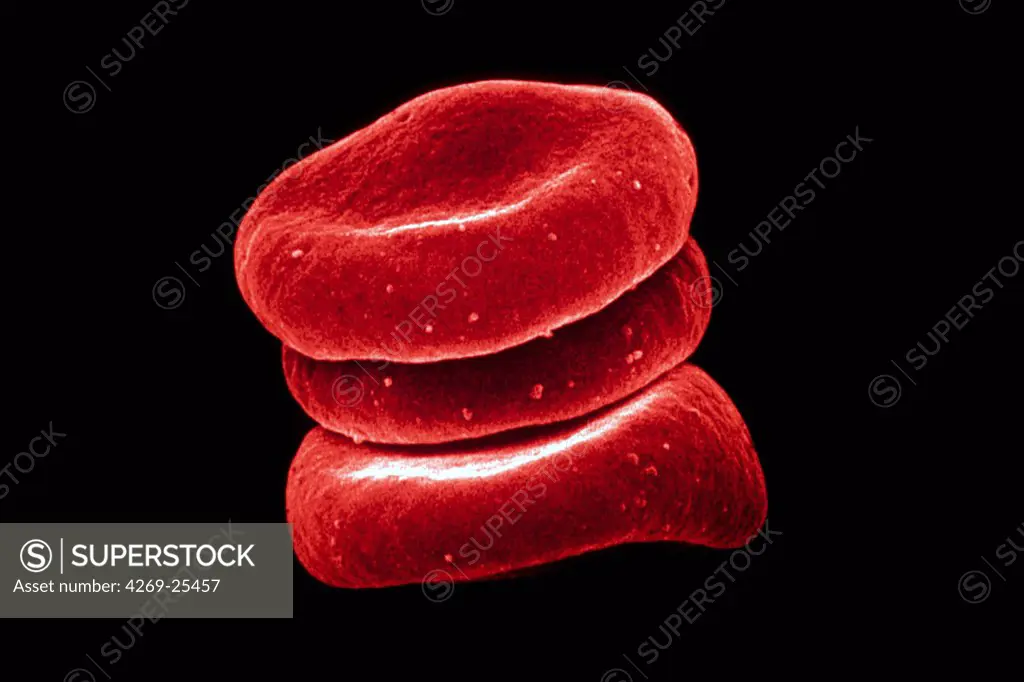 Blood cell. Blood red cells SEM (Scanning Electron Microscope)