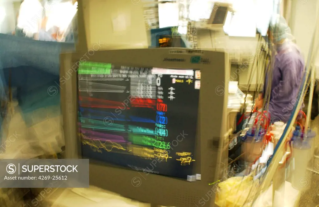 Surgery. Anaesthesia monitoring screen. This monitor shows the patient's vital signs during surgical procedure.