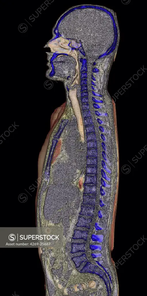 Back. 3D computed tomographic (CT) scan reconstruction (longitudinal side-section) of the trunk showing the bonny structures in blue (skull and backbone) and the internal organs in grey. The nasal cavity (sinus) and the trachea appear in white.