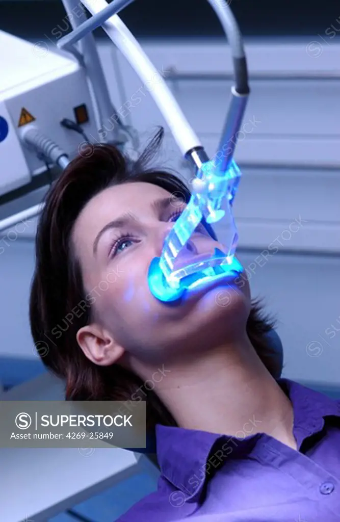 Tooth bleaching. Application of a gel containing hydrogen peroxide (15%) during 20 to 90 minutes which is activated by a lamp of high energy to accelerate the process of bleaching.