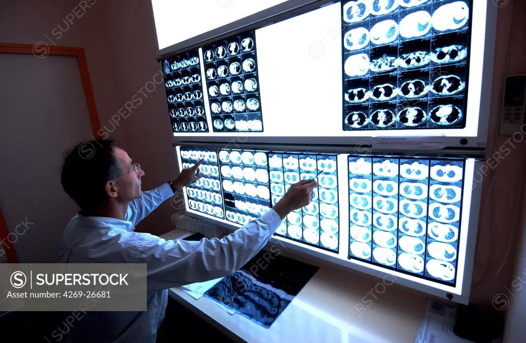 Radiologist. radiologist examining a set of CT scans.