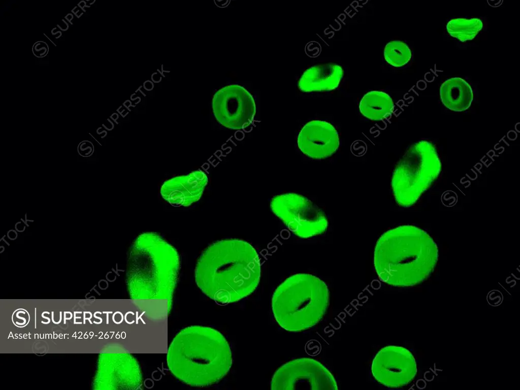 Red blood cells production. In vitro production of human mature and functional red blood cells from stem blood cells called CD34, Professor Luc Douay's research team, Saint Antoine Faculty of Medicine, Paris. Confocal micrograph showing red blood cells.