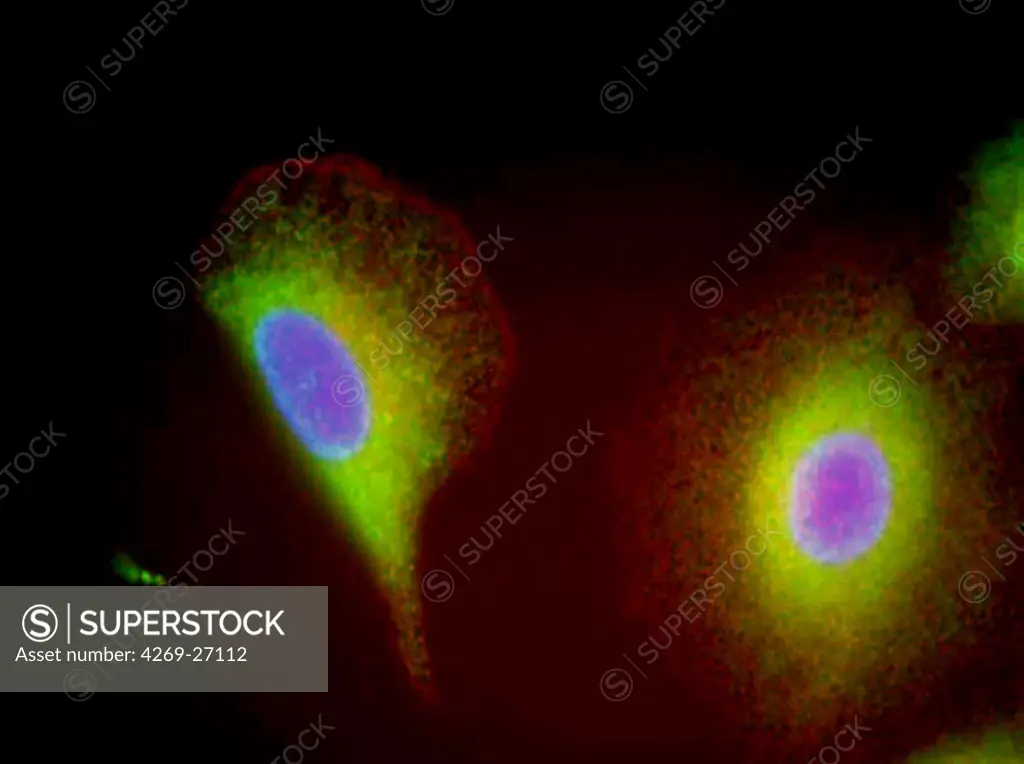 Lung cells. Fluorescent light micrograph of cultured lung cells made for researches on mucoviscidosis.