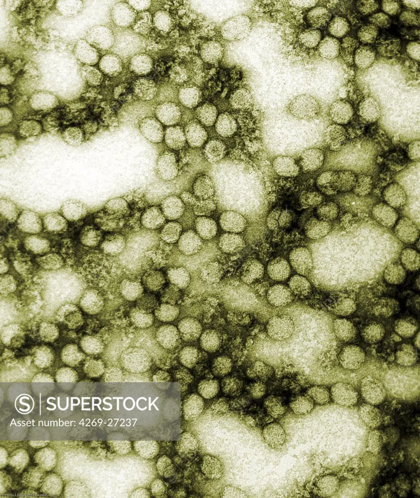 Yellow fever. Transmission electron micrograph (TEM) of yellow fever viruses. The yellow fever virus is a flavivirus of the togavirus class. Magnification x 234,000.