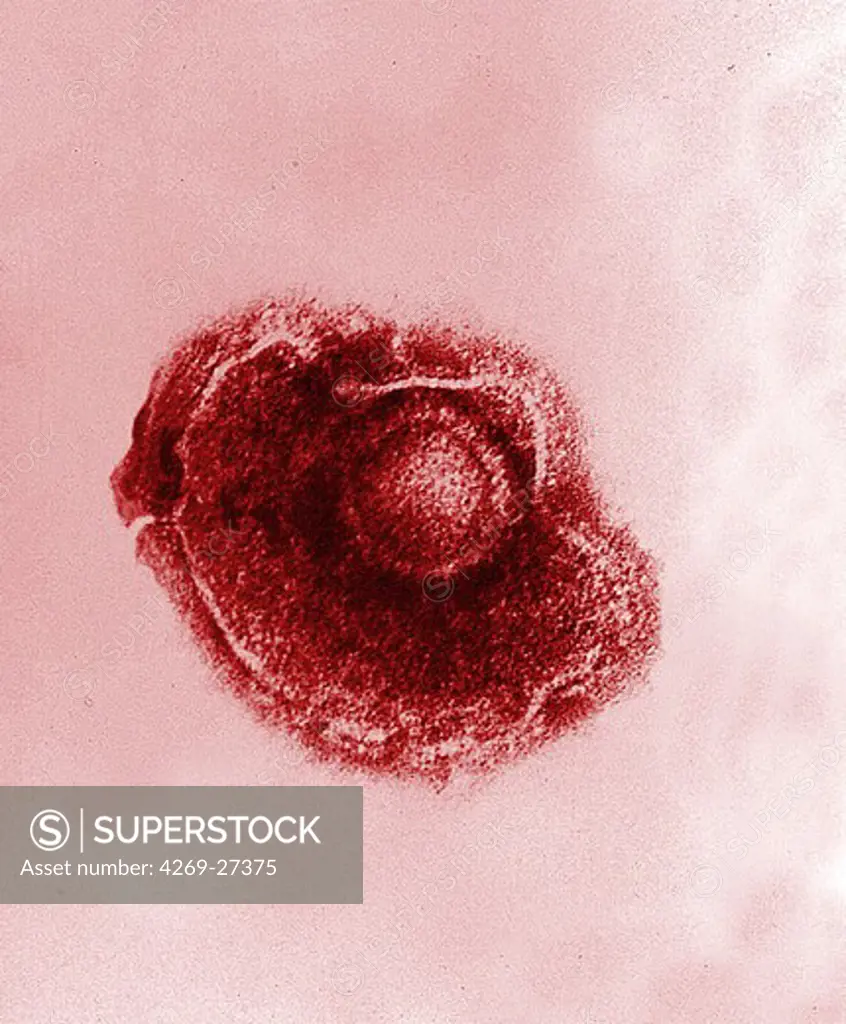 Varicella-zoster virus. Color enhanced electron micrograph of Varicella (Chickenpox) virus. The infectious disease known as Chickenpox is caused by the varicella-zoster virus, a DNA virus of the Herpesvirus.