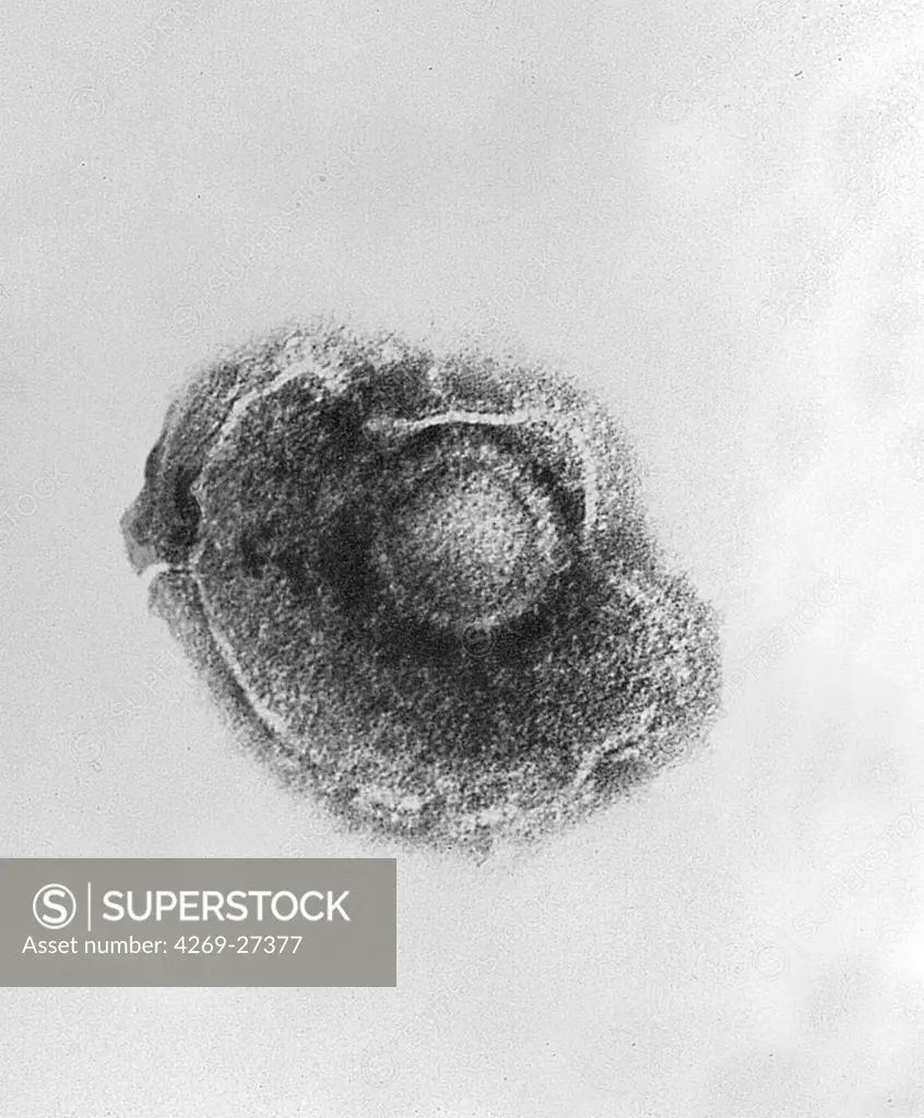 Varicella-zoster virus. Color enhanced electron micrograph of Varicella (Chickenpox) virus. The infectious disease known as Chickenpox is caused by the varicella-zoster virus, a DNA virus of the Herpesvirus.