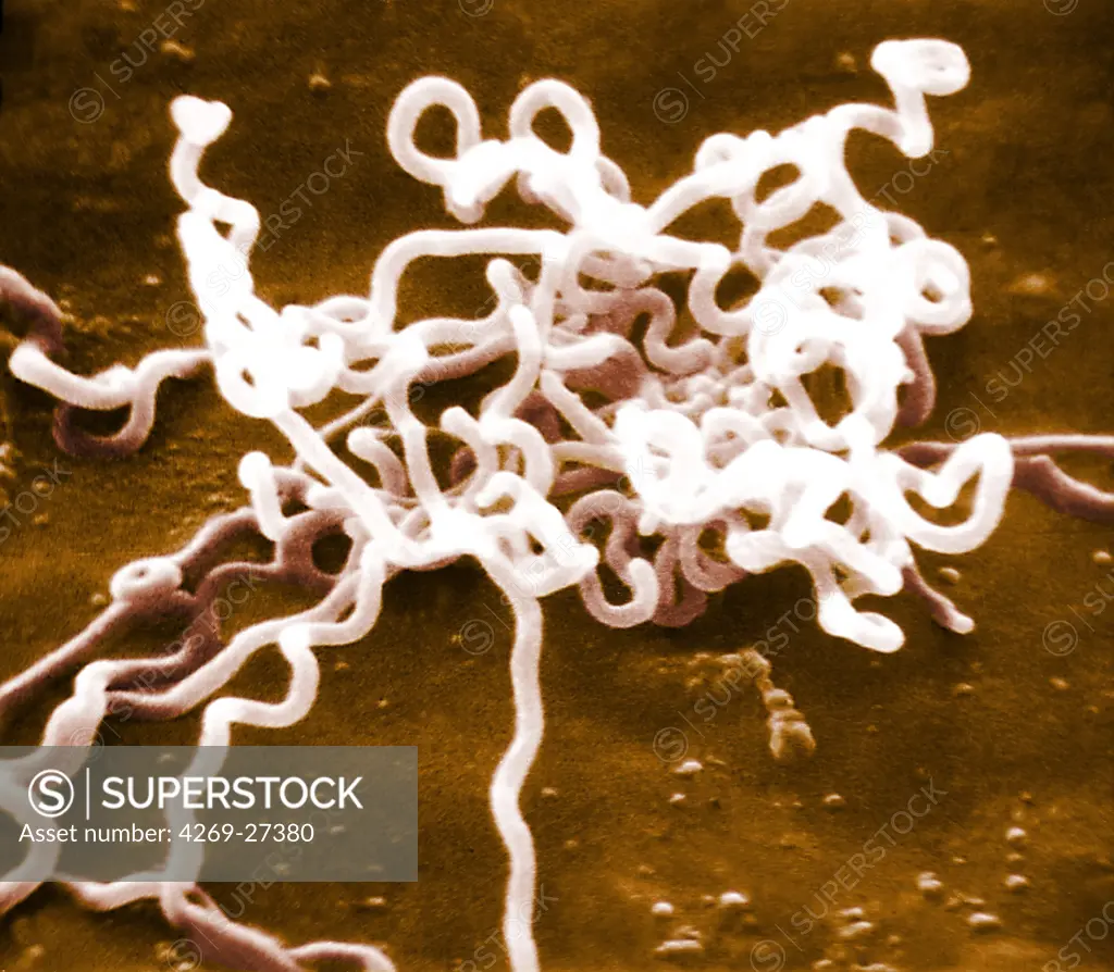 Treponema pallidum. Scanning Electron Micrograph (SEM) of Treponema pallidum. This spirochaete bacterium is the agent of syphilis.