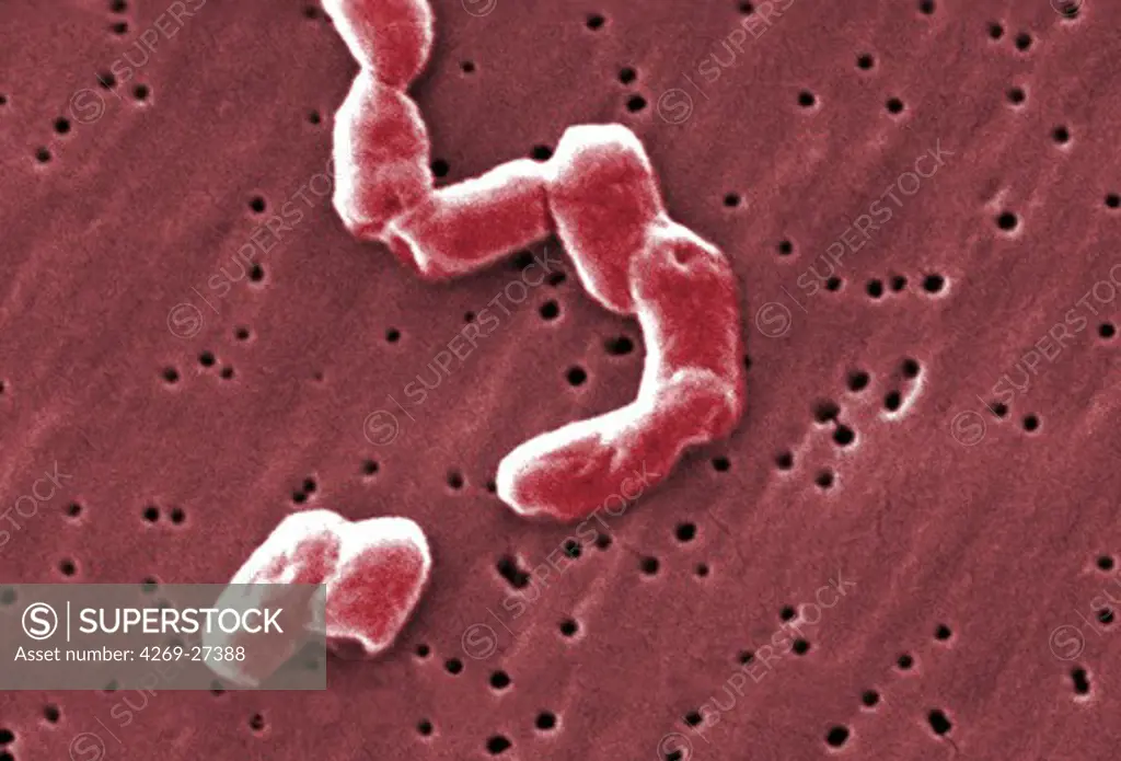 Salmonella infantis. Scanning electron micrograph (SEM) of rod-shaped, motile, Gram-negative Salmonella infantis bacteria. Magnification 18875x. When ingested with spoiled food, the bacteria of the genus Salmonella are responsible for salmonellosis, a small intestine infection (gastroenteritis).