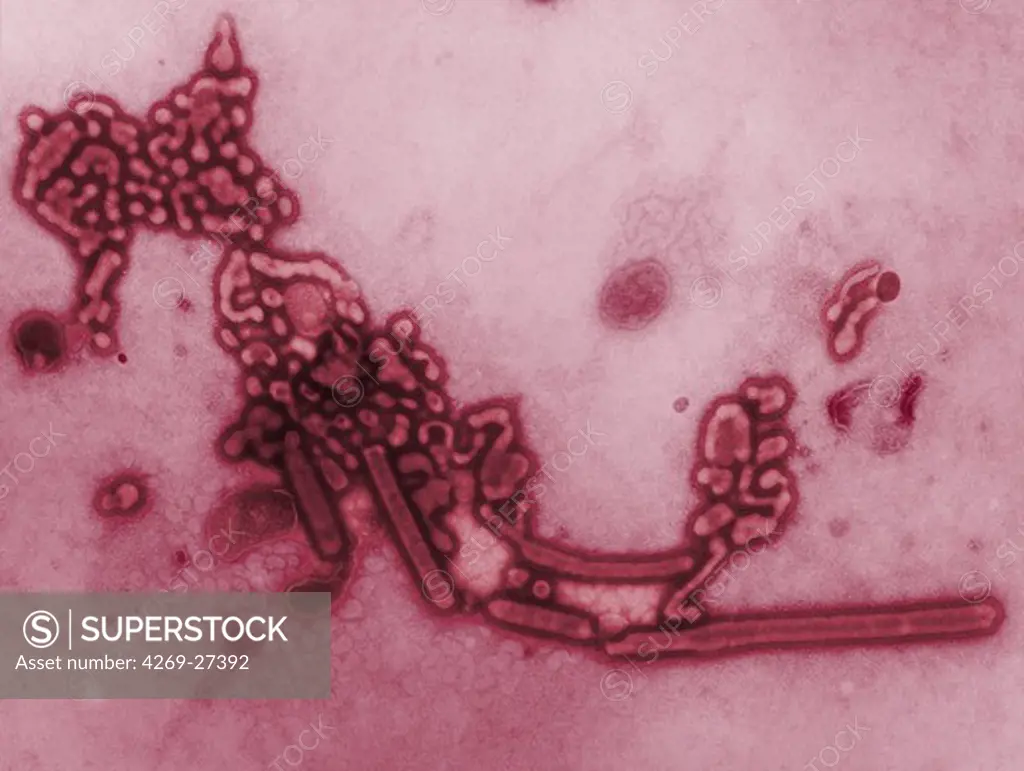 Influenza virus. Transmission electron micrograph (TEM) of Russian flu. Strain H1N1 (A/USSR/90/77) which infected children and young adults in Russia in 1977-78. Magnification 189,000x.