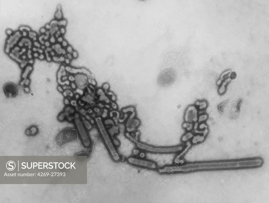 Influenza virus. Transmission electron micrograph (TEM) of Russian fu. This Influenza virus type a, strain H1N1 (A/USSR/90/77) infected children and young adults in Russia in 1977-78. It is very close from 1918 Spanish flu virus which infected a fifth of the world population and killed between 20 and 50 million, and from the swine flu in Mexico en 2009. Magnification 189,000x.