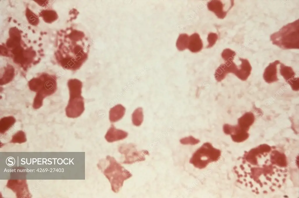 Neisseria gonorrhoeae. Photomicrograph of Neisseria gonorrhoeae, an aerobic Gram-negative bacterium responsable for the Sexually transmitted infection Gonorrhea.