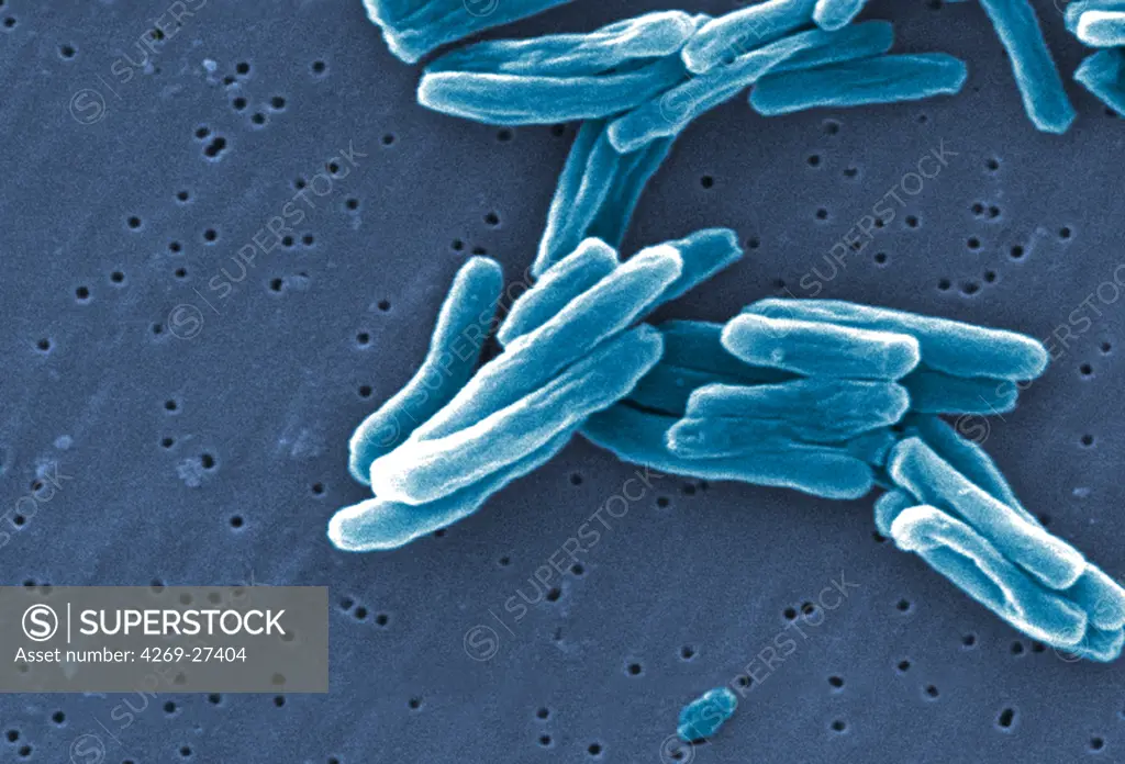 Mycobacterium tuberculosis. Scanning electron micrograph (SEM) of Gram-positive Mycobacterium tuberculosis bacilli, the causative agent for tuberculosis. Magnification 15549x.