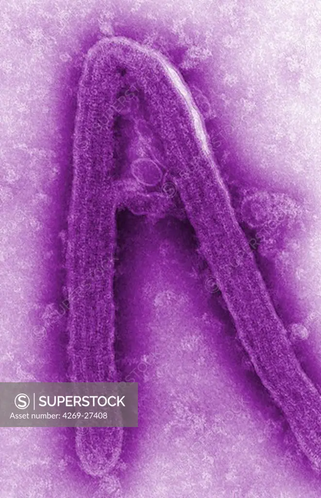 Marburg virus. Transmission electron micrograph (TEM) of filamentous Marburg virus.This RNA virus of the Filovirus (like Ebola) is known to cause Marburg hemorrhagic fever, which can be fatal.