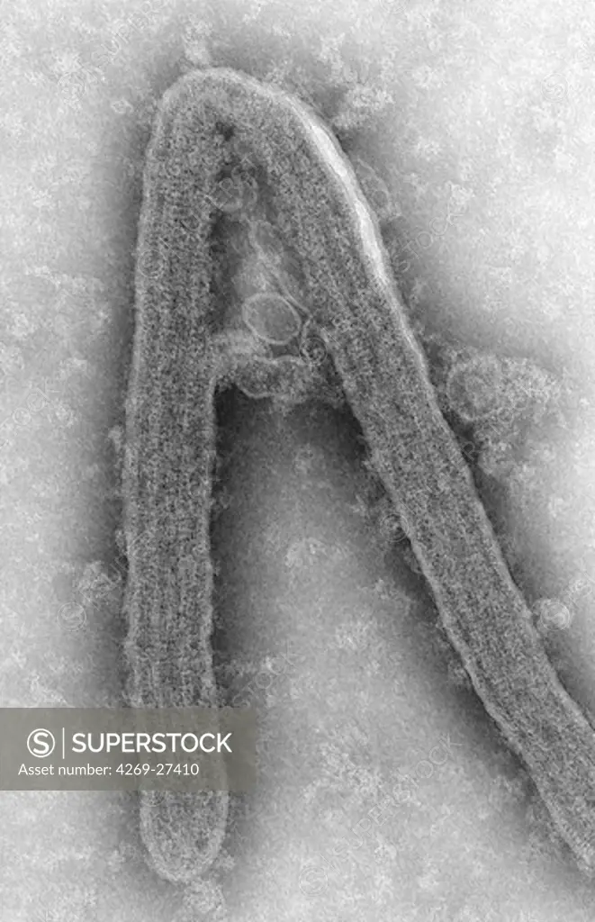 Marburg virus. Transmission electron micrograph (TEM) of filamentous Marburg virus.This RNA virus of the Filovirus (like Ebola) is known to cause Marburg hemorrhagic fever, which can be fatal.