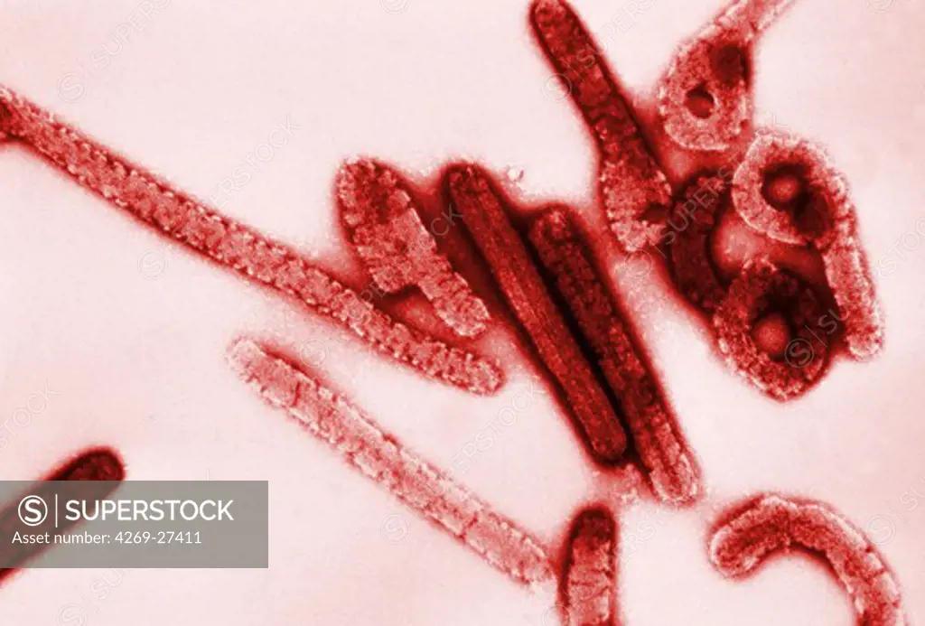 Marburg virus. Transmission electron micrograph (TEM) of filamentous Marburg virus, magnified 100,000x. This RNA virus of the Filovirus (like Ebola) is known to cause Marburg hemorrhagic fever, which can be fatal.