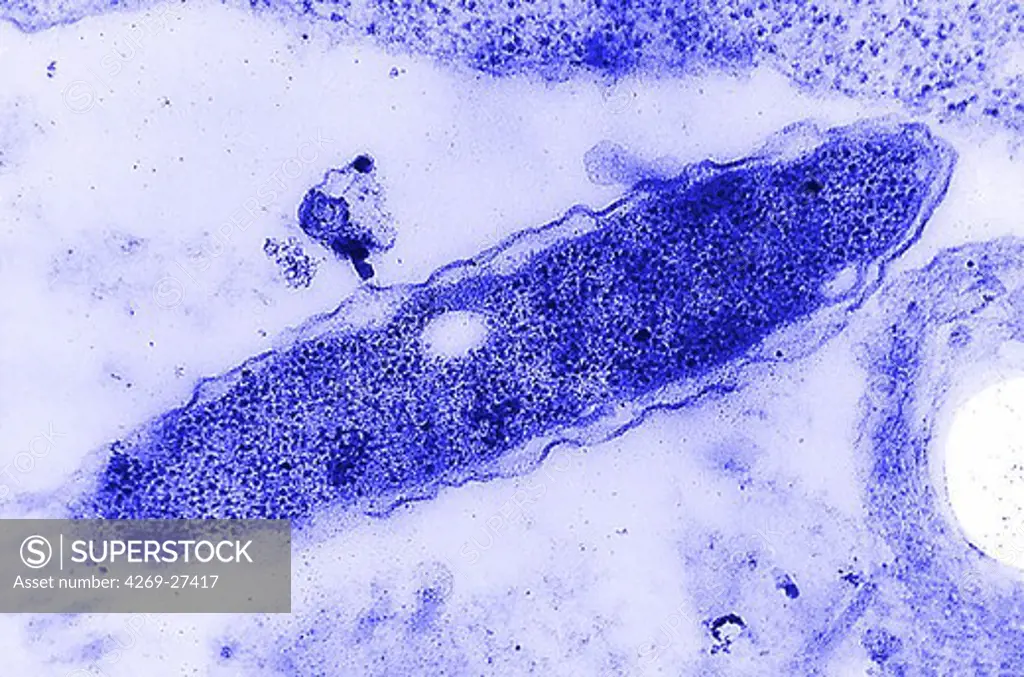 Legionella pneumophila. Transmission electron micrograph (TEM) of Legionella pneumophila, the bacteria known to cause Legionnaires' disease. Legionnaires' disease, also known as Legionellosis, is associated with poorly maintained air conditioning cooling towers and potable water systems. Often associated with nosocomial infections. Magnified approximately 119,500x.