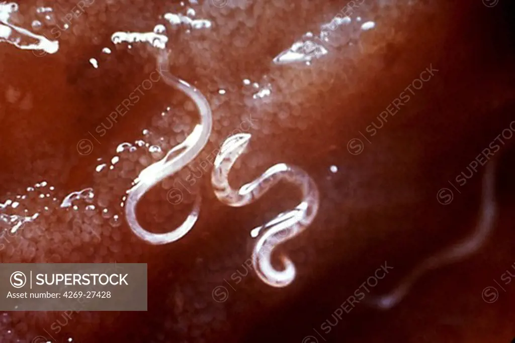 Ancylostoma caninum. This enlargement shows a dog hookworm (Ancylostoma caninum) attached to intestinal mucosa. Barely visible larvae penetrate the skin (often through bare feet), are carried to the lungs, travel through the respiratory tract to the mouth, are swallowed, and eventually reach the small intestine.