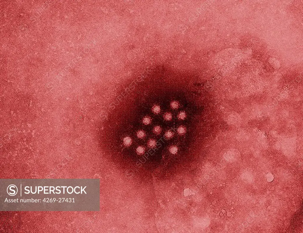 Hepatitis A virus. Color enhanced Transmission Electron Micrograph (TEM) of the Hepatitis A virus (HAV, Picornaviridae).
