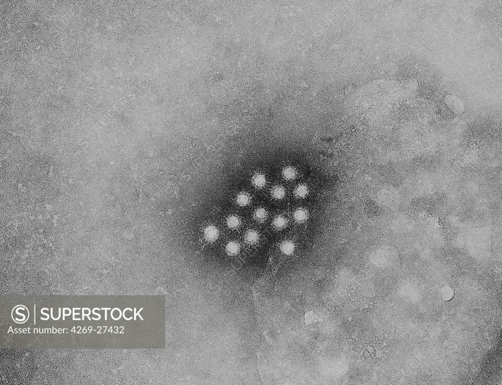 Hepatitis A virus. Color enhanced Transmission Electron Micrograph (TEM) of the Hepatitis A virus (HAV, Picornaviridae).