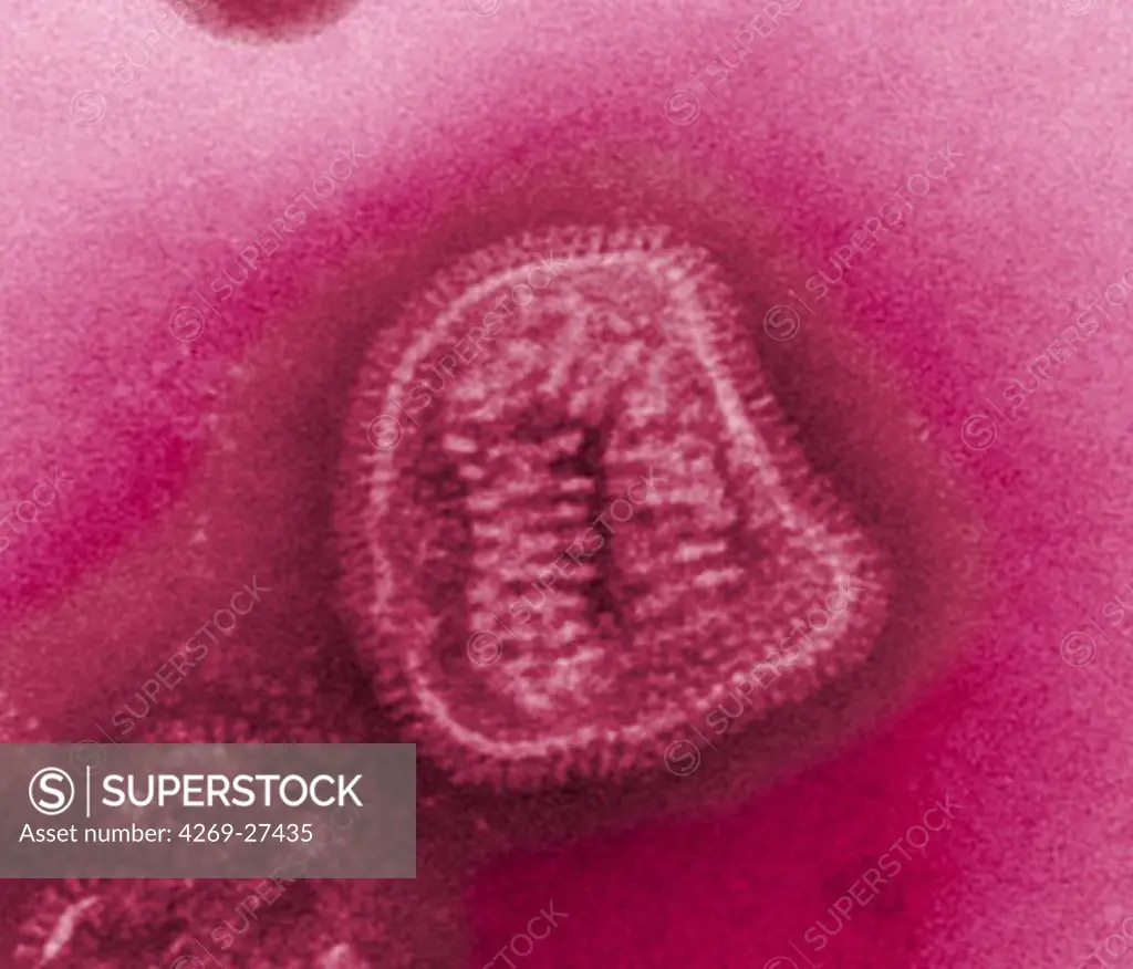 Influenza virus. Transmission electron micrograph (TEM) of an influenza virus. Influenza virus are RNA virus (orthomyxoviridae).