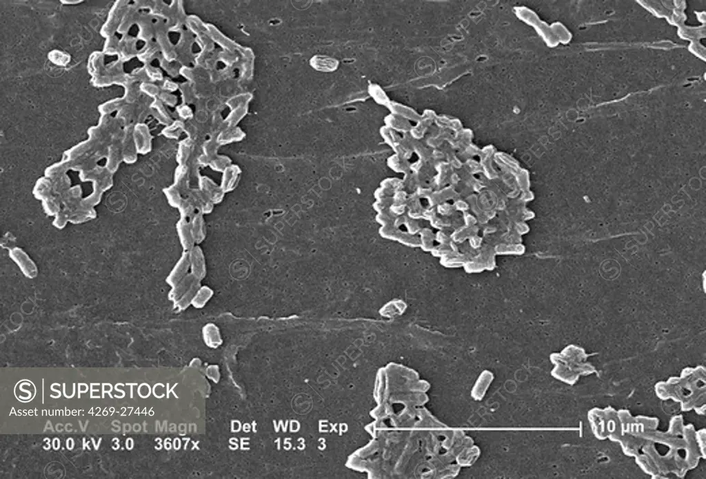 Escherichia coli. This scanning electron micrograph (SEM) of a Escherichia coli bacterium ; Magnification 3607x. E. coli are rod-shaped Gram-negative bacteria that normally colonize the digestive tract in humans and other animals. However, some strains can produce a toxin that leads to severe illness or even death.