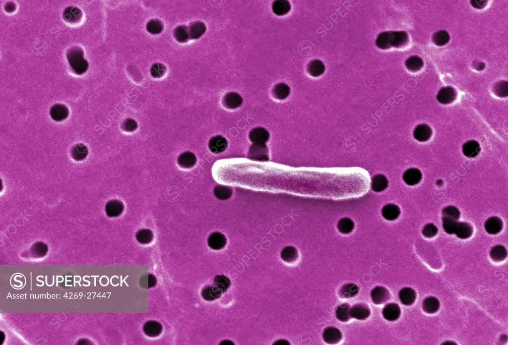 Escherichia coli. This scanning electron micrograph (SEM) of a Escherichia coli bacterium ; Magnification 12800x. E. coli are rod-shaped Gram-negative bacteria that normally colonize the digestive tract in humans and other animals. However, some strains can produce a toxin that leads to severe illness or even death.