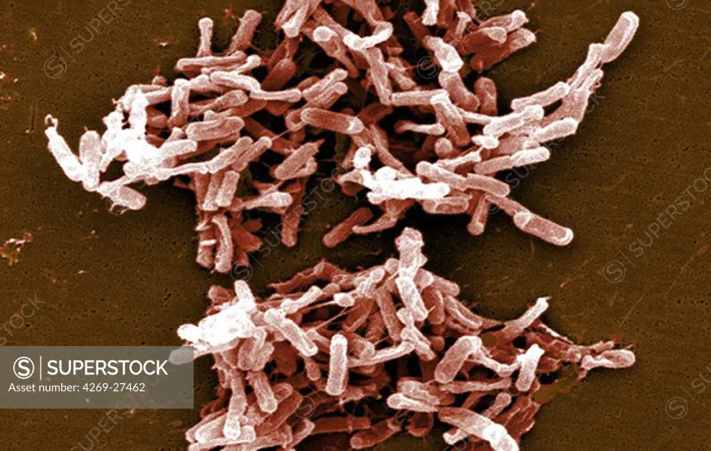 Clostridium difficile. Scanning Electron Micrograph (SEM) of Clostridium difficile bacteria. C. difficile, an anaerobic gram-positive rod, is the most frequent cause of antibiotic-associated diarrhea (AAC).