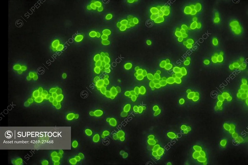 Candida albicans. Fluorescent antibody stain micrograph of budding yeast cells of Candida albicans. Candida albicans is a single-celled fungus commonly found with man and usually harmless. However, it can sometimes causes infections like oral thrush, vaginal thrush and diaper rash.