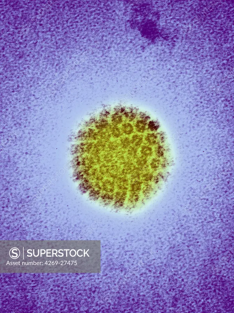 Human Papillomavirus. Colored transmission electron micrograph (TEM) of human papillomavirus (HPV). The HPV is involved in the development of cervical cancers.