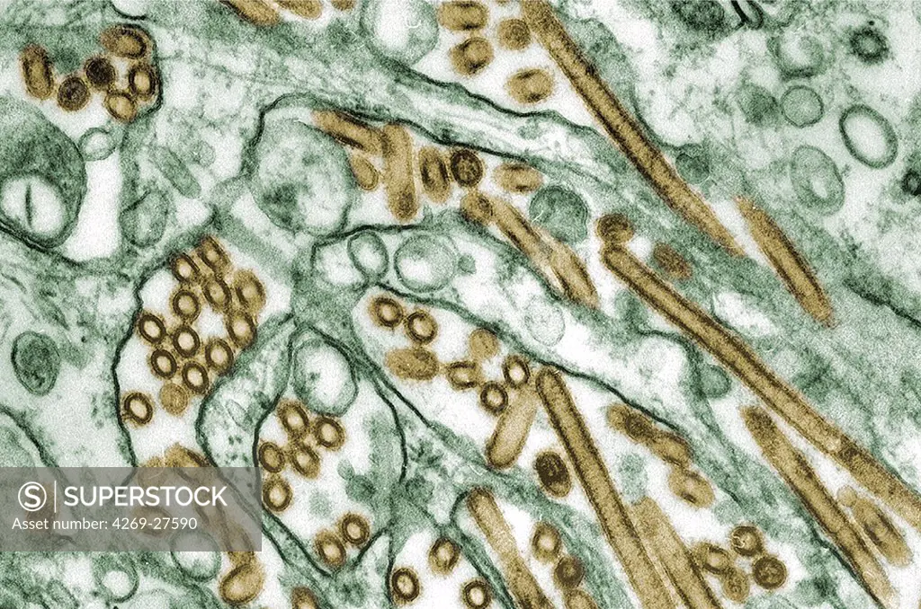 H5N1 virus. Colorized transmission electron micrograph of avian influenza A H5N1 viruses (seen in gold) grown in Madin-Darby canine kidney (MDCK) cells (seen in green).