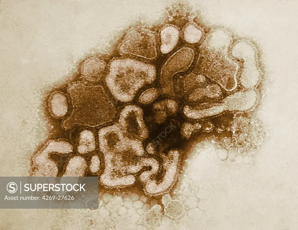 Spanish flu virus. Transmission Electron Micrograph (TEM) of Spanish flu virus. This pandemic virus infected a fifth of the world population and killed between 20 and 50 million. This Influenza virus type a, strain H1N1 is very close to the swine flu (strain H1N1) and the avian flu virus (strain H5N1).