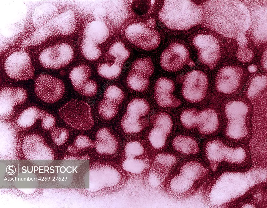 Influenza virus. Influenza A virus causes flu in humans, swine, birds, horses and dogs. Which species the virus will infect is determined by the glycoprotein spikes on its outer envelope. They are many strains of influenza A virus, among which the avian flu virus (H5N1), swine flu (H1N1) or human. Transmission Electron Micrograph (TEM).