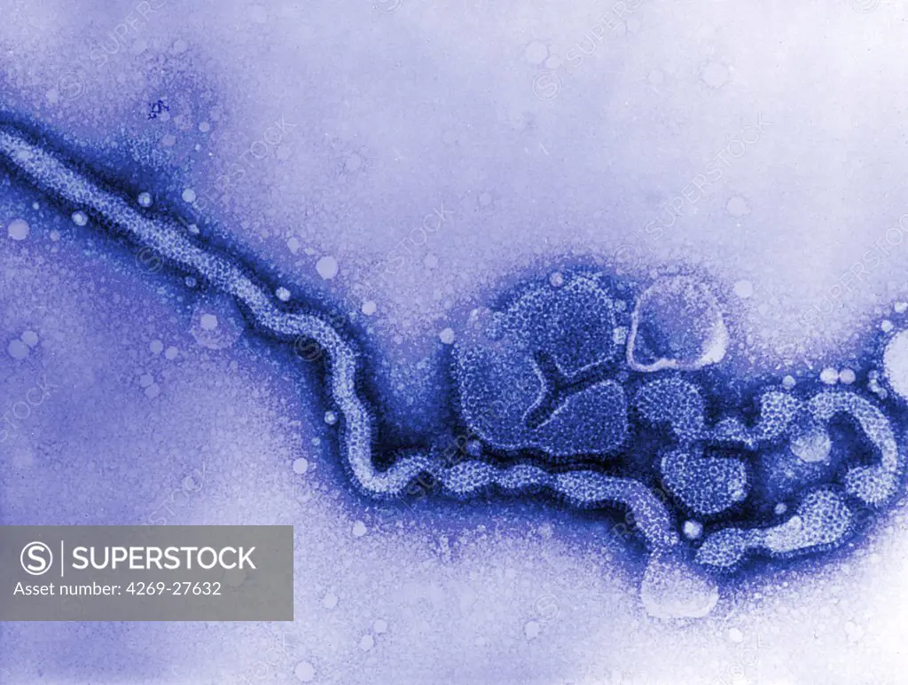 Influenza virus. Transmission electron micrograph of influenza C virus.
