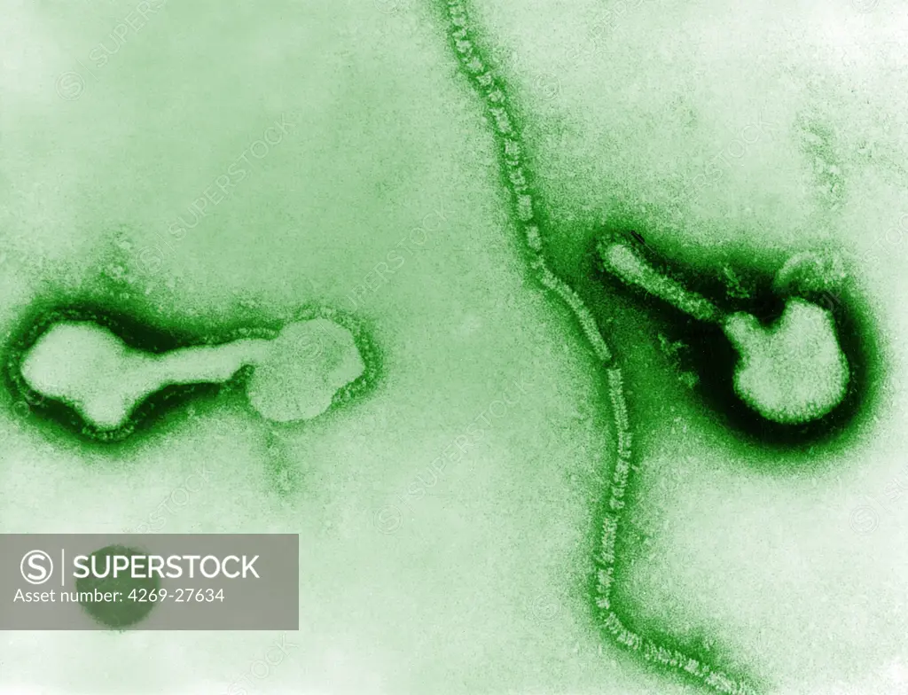 Parainfluenza virus. Transmission electron micrograph (TEM) of parainfluenza virus. This RNA virus of the paramyxovirus class causes minor respiratory infections.