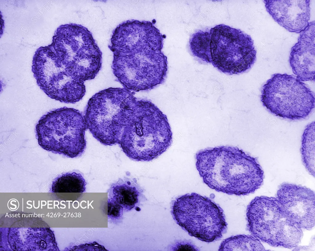 Neisseria gonorrhoeae. Electron micrograph of Neisseria gonorrhoeae, an aerobic Gram-negative bacterium responsible for the Sexually transmitted infection Gonorrhea. Approximate mag. 100,000X.