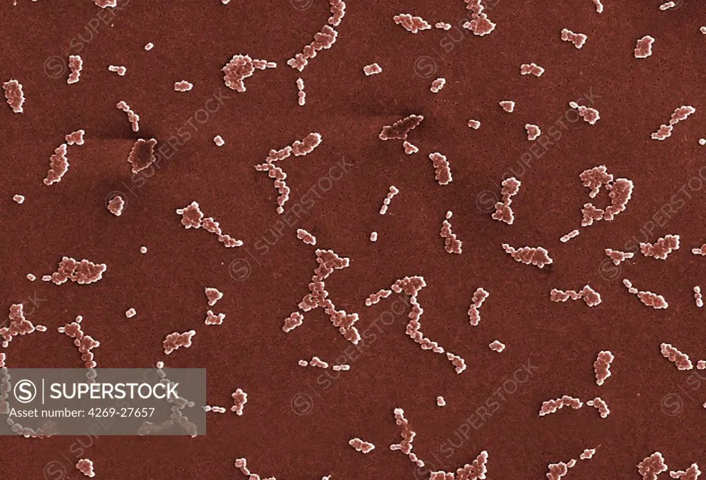 Acinetobacter baumannii. Scanning Electron micrograph (SEM) of Acinetobacter baumannii. This aerobic Gram-negative, non-motile bacteria are normal flora on the skin. But because A. baumannii has developed substantial antimicrobial resistance, it is an emerging cause of nosocomial infections in hospitals, responsible for pneumoniae, hemopathic and wound infections. Magnification of 1546x.