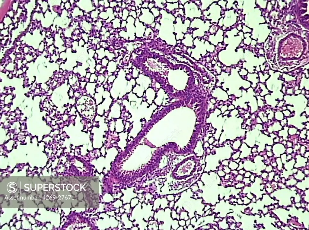 Lung. Photomicrograph of lung tissus showing a section of brunchus at center with surrounding blood vessels.