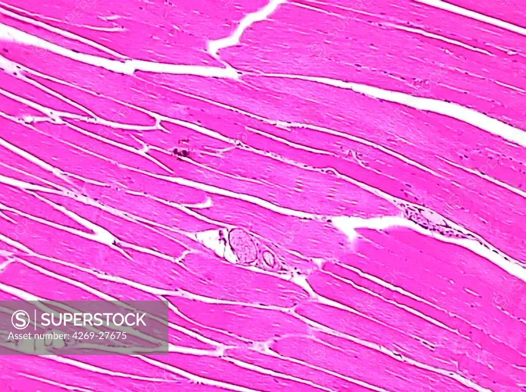 Striated muscle. Photomicrograph of cells of striated muscle.