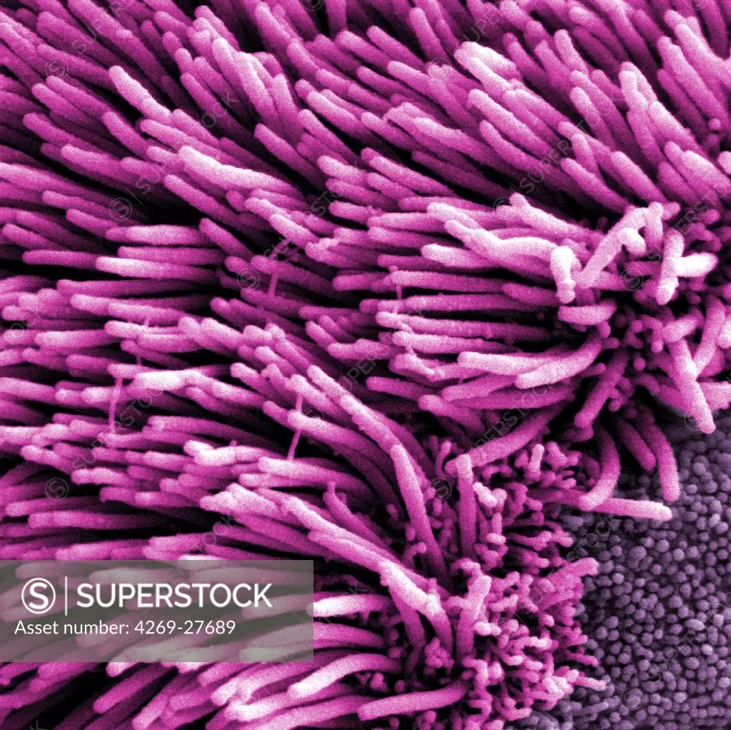 Lung trachea epithelium. Scanning electron micrograph (SEM) of the lung trachea epithelium which consists of ciliated cells seen here, and non-ciliated cells (bottom right).