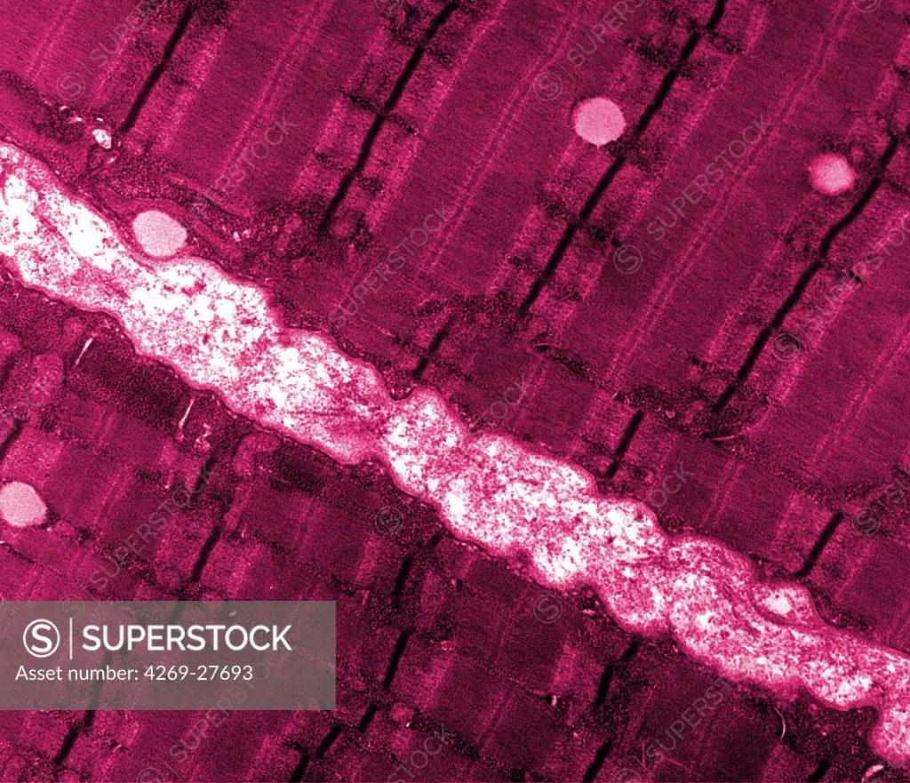 Muscle fiber. Transmission electron micrograph (TEM) of a thin longitudinal section cut through an area of human skeletal muscle tissue. Image shows several myofibrils, each with the distinct banding pattern of individual sarcomeres.