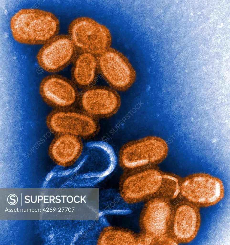 Influenza virus. Influenza A virus causes flu in humans, swine, birds, horses and dogs. Which species the virus will infect is determined by the glycoprotein spikes on its outer envelope. They are many strains of influenza A virus, among which the avian flu virus (H5N1), swine flu (H1N1) or human. Transmission Electron Micrograph (TEM).